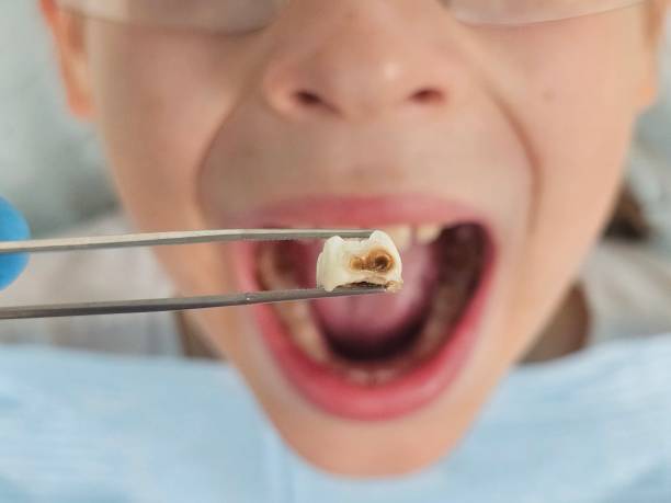 Best Emergency Dentist Open Today  in Perry Hall, MD